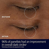 Before and after comparison of dark circles under eyes with clinical testing results.