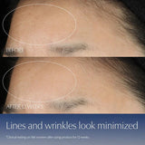 Before and after comparison of lines and wrinkles on a person's forehead with text indicating improvement after 12 weeks.